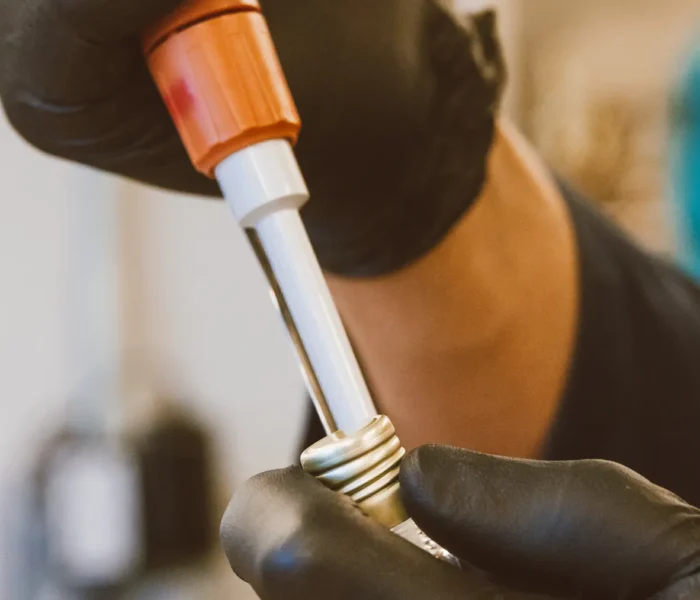 Laborfachkraft arbeitet mit Pipette und Probengefäß bei einer molekularbiologischen Untersuchung. Symbolbild zur QIAGEN-Übernahme.